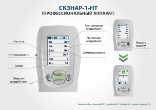 СКЭНАР-1-НТ (исполнение 01)  в Ставрополе купить Медицинская техника - denasosteo.ru 